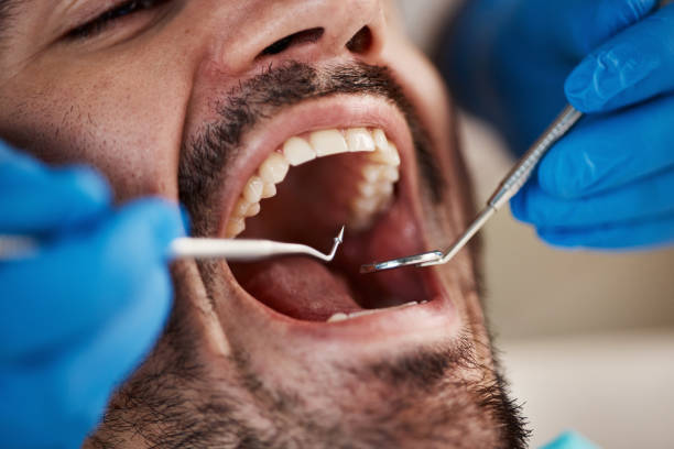 Best Urgent Tooth Repair  in Kenworth, IL