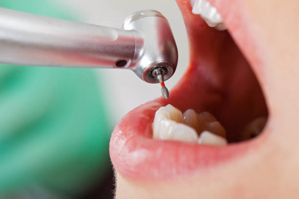 Best Knocked-Out Tooth Emergency  in Kenworth, IL
